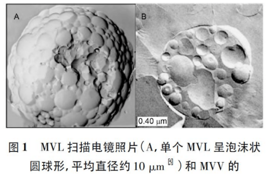 多囊系统是一种较新颖的脂质递药系统,分为多囊脂质体和多囊囊泡,其