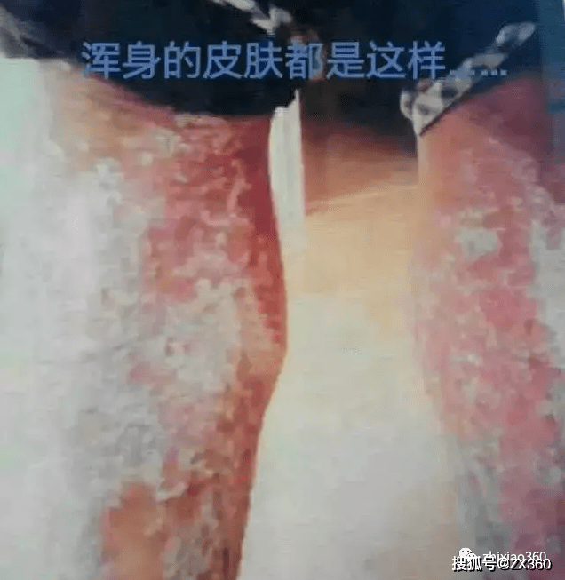 金科伟业净水器暴利背后的真相：不少经销商倾家荡产(图6)