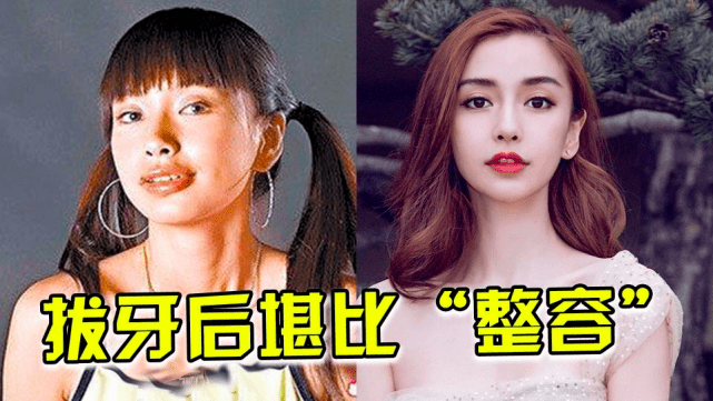 比如楊冪,angelababy,她們一直都對外堅稱自己之所以和以前長得不一樣