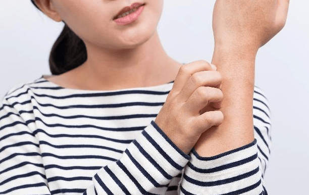 儿童荨麻疹春季常反复发作 抓好三件事情 一天比一天好 小儿