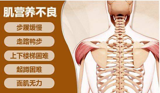 良性型进行性肌营养不良:也是x连锁隐性遗传,男性发病,女性传递