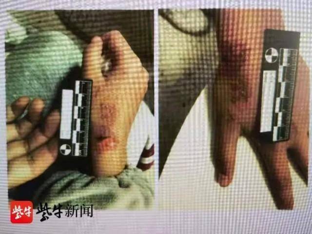 家长棍棒教育 妈妈暴力逼迫12岁女儿学大学英语 被撤销监护权 佳佳