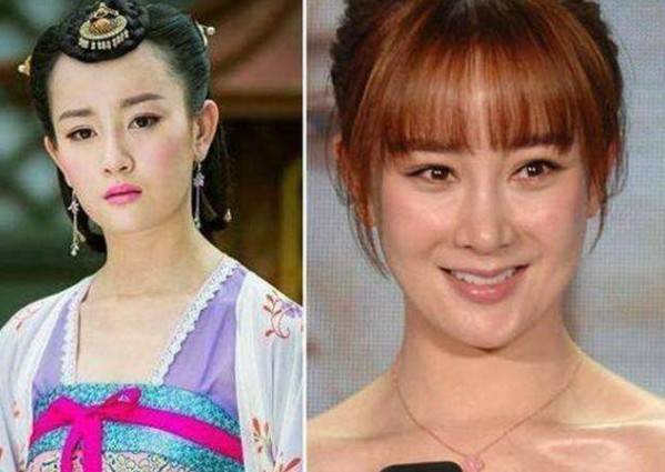 被玻尿酸毁了的女星:娄艺潇脸部变形,曹颖认不出,她成"妖怪"