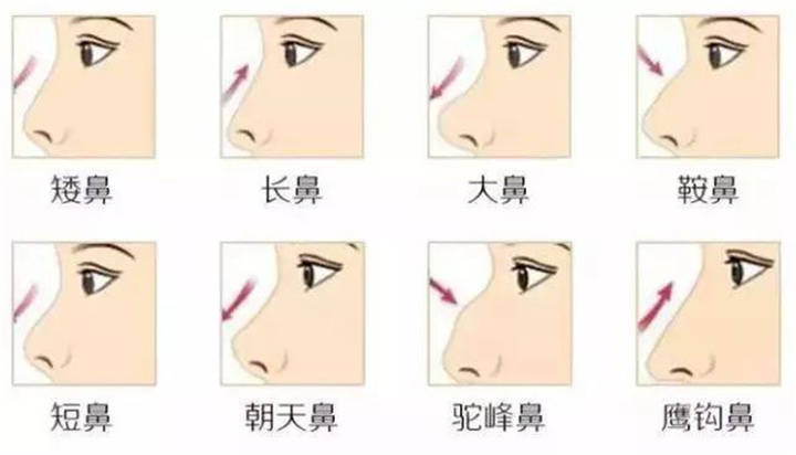 眼是美之窗鼻是颜之魂范芳医生谈国人常见鼻型及美学特点三
