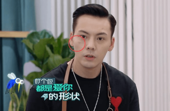 陈伟霆录综艺被蚊子叮居然完全不知晓网友眼神不好