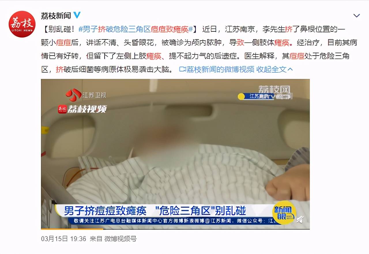 痤疮饮食安排 17b9efbd538148069210f70ca0615003.jpeg