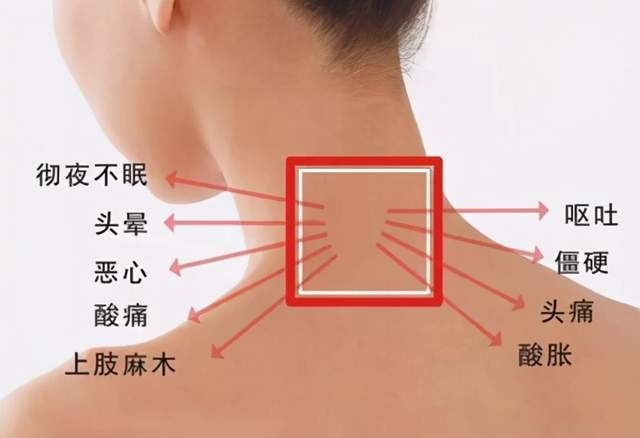 颈型神经根交感神经椎动脉型颈椎病都适合哪种运动疗法