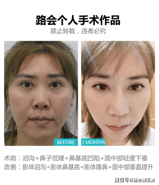 7088307b70c54232ab569e145c95e4b5.png