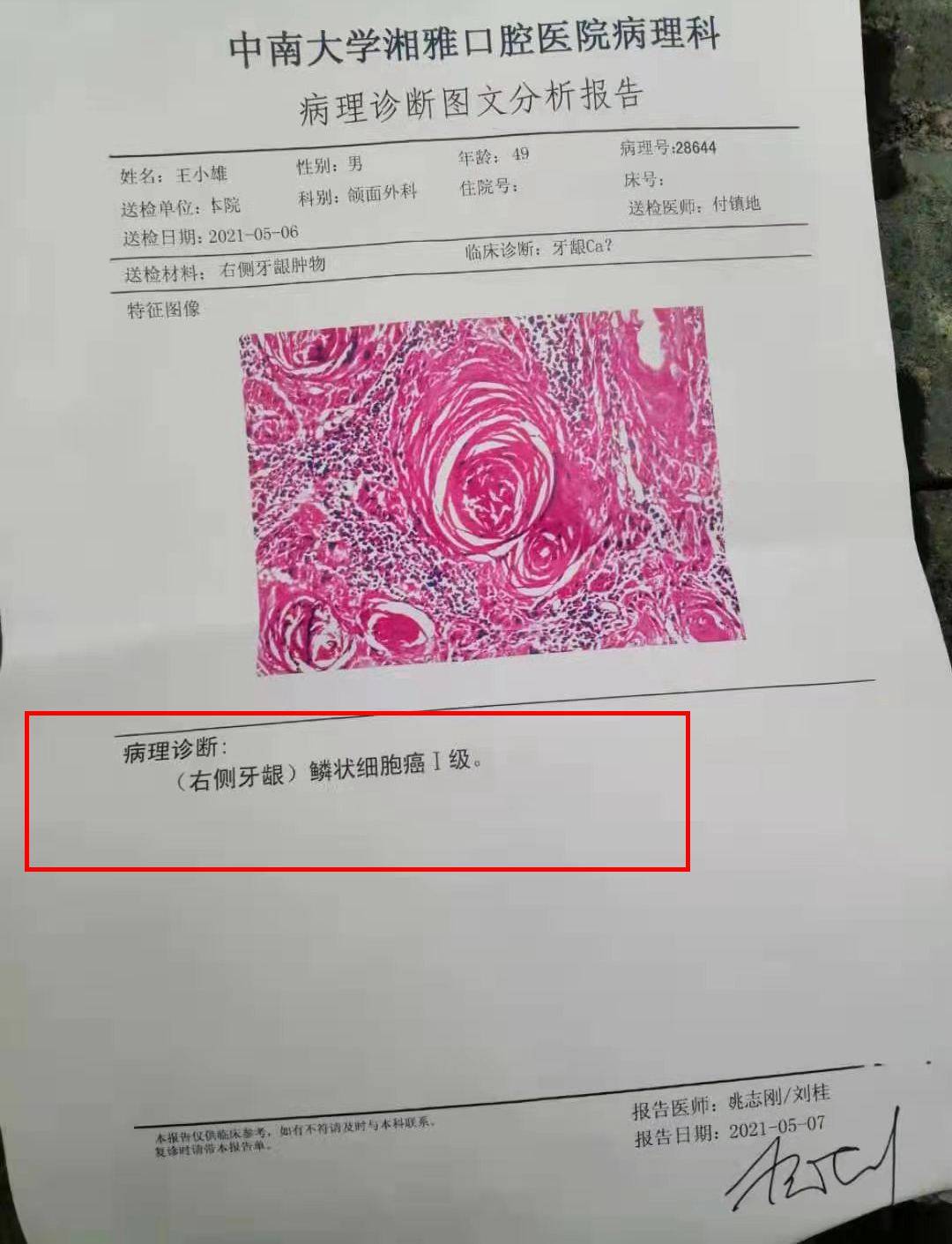 武冈初二中学生为父求助我爸爸才49岁确诊口腔癌急需手术