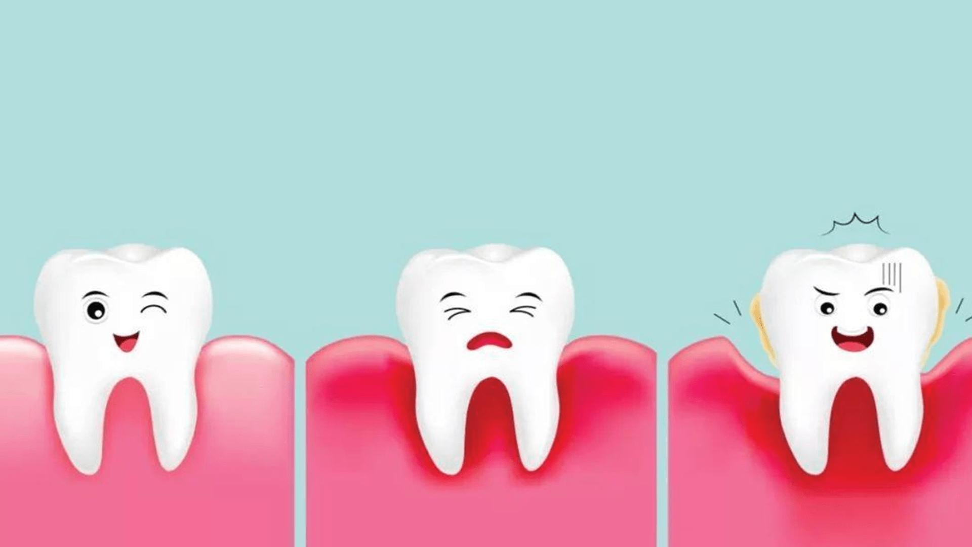 牙结石是如何形成的？究竟有何危害？如何清除比较好？一文科普！|牙结石|牙周|牙齿_新浪新闻