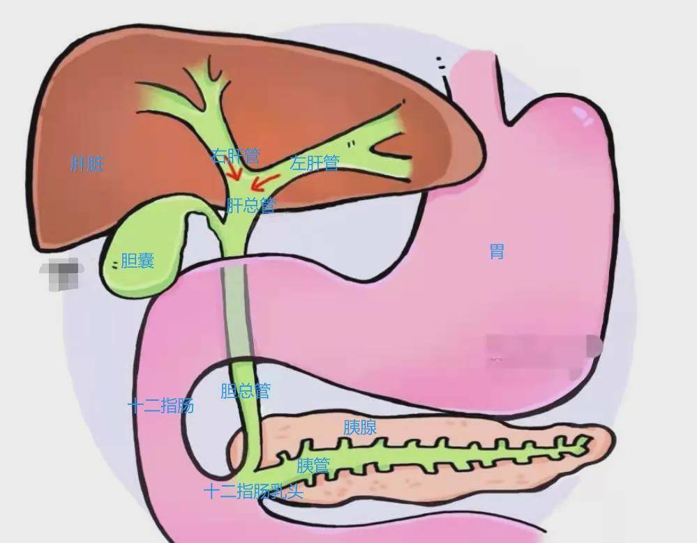 胆囊管与肝总管汇合成胆总管,胆总管与胰管相遇,一起进入十二指肠肠壁