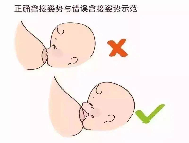 母乳喂养时乳头为何疼痛?