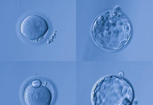 什么时候检测卵泡数量 9e15809a4d8b4ece9a381754f50c08f8.jpeg