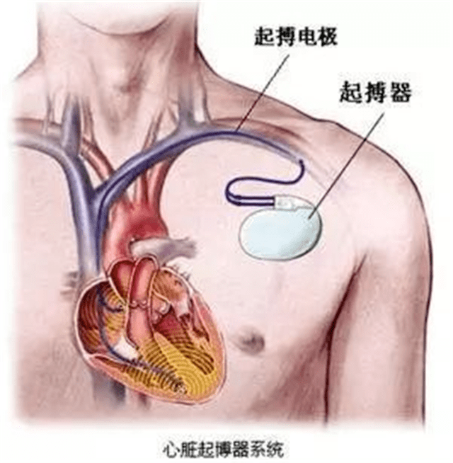 心尖搏动位置图片