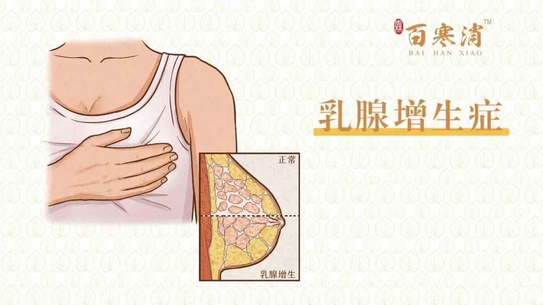 姜爱女性三部曲(一):她是女人最容易受伤的地方_乳腺