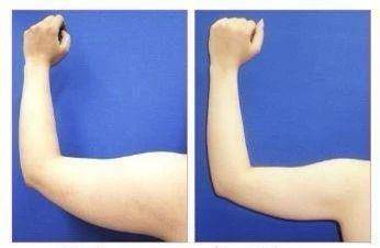 怎么样减肥才不会有赘肉和反弹 a8cc03db7fce44f6833f50c1fa06423f.jpeg