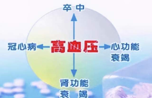 如何预防脑卒中发生 956ebe9159974e6683ff8de501ec2b89.jpeg