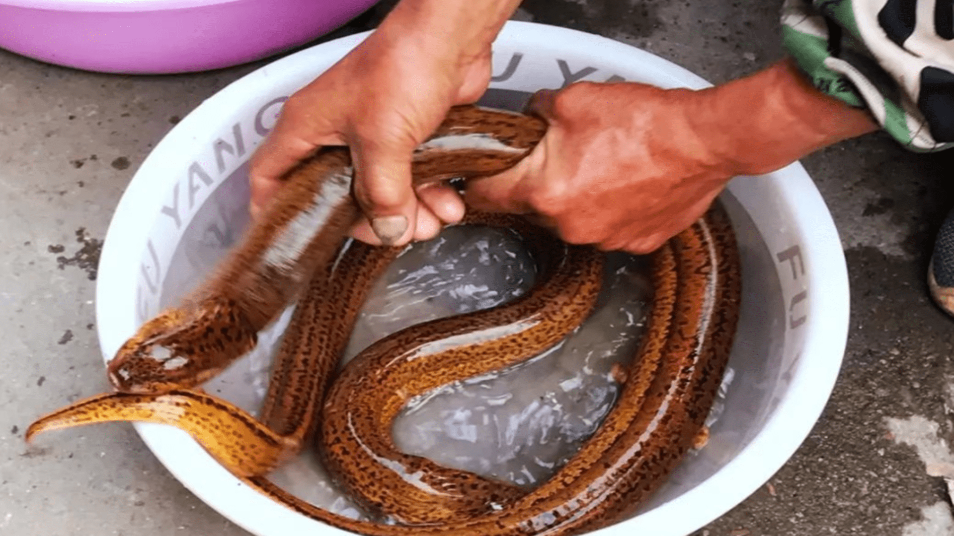 被一条活黄鳝钻进了他的肛门里面,后来腹胀了2小时,但是并没有在粪便