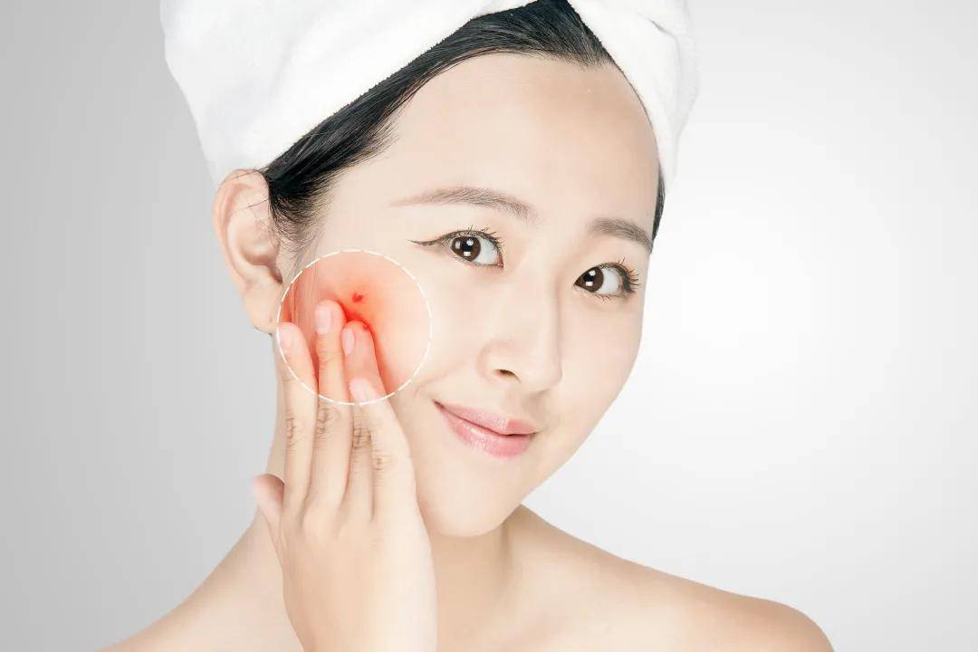 怎么护肤才能使皮肤变好 2c31b6b2b433401e9917f96088b64d18.jpeg