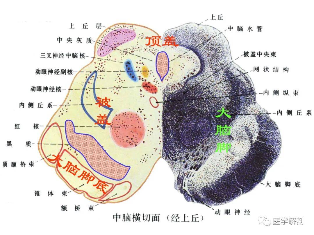 内侧纵束解剖图图片