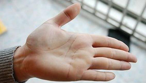 手掌是肝脏的晴雨表,若出现3大迹象,肝脏或已稀烂