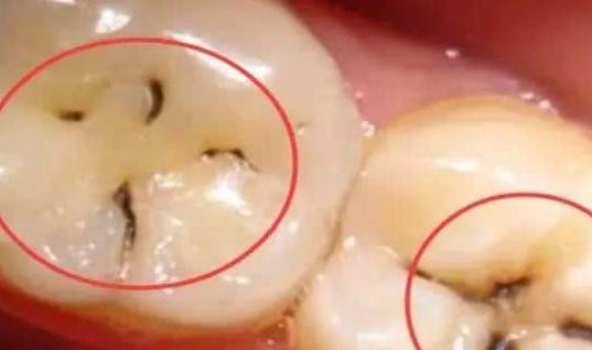 一般多久洗牙 ecc5552c98d448a58577d1fffb212fa5.jpeg