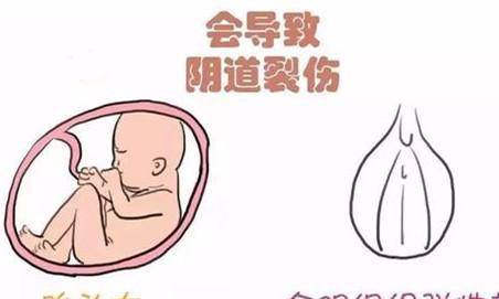 而软产道主要是由子宫颈,子宫峡部等部位构成的,在分娩过程中软产道有