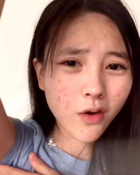 网红素颜出镜,韩安冉皮肤干净,小霸宠满脸痘遮不住高颜值!