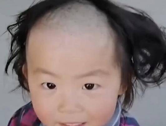 原创5岁女儿偷玩理发器剃头后秒变谢广坤网友忍不住笑出声