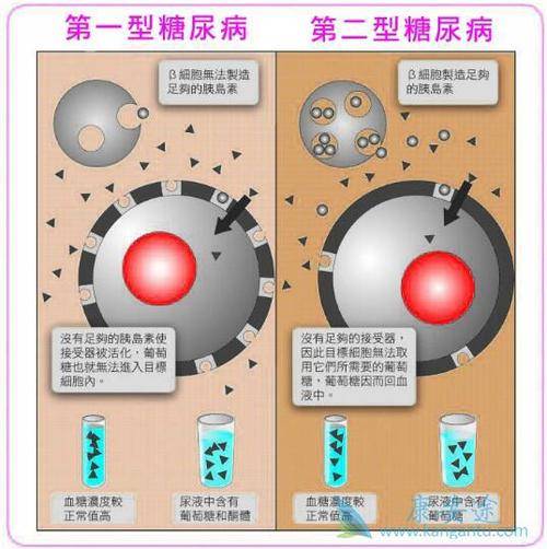 糖尿病(diabetes mellitus, dm)是一组由胰岛素分泌不足或胰岛素抵抗