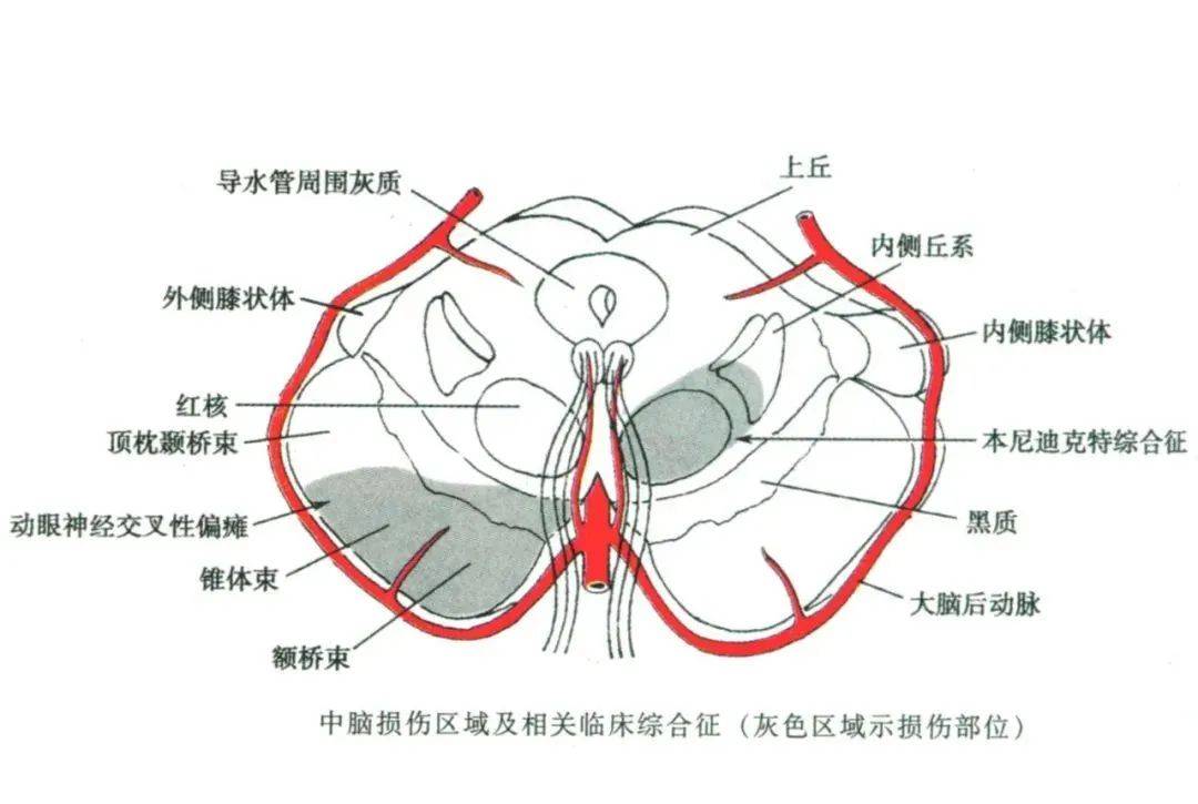 【收藏帖】脑干内部超详细功能解剖图