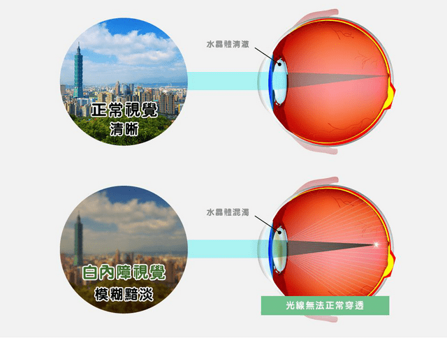8247417ca0cd4877aa7b4bf9e4922df1.png