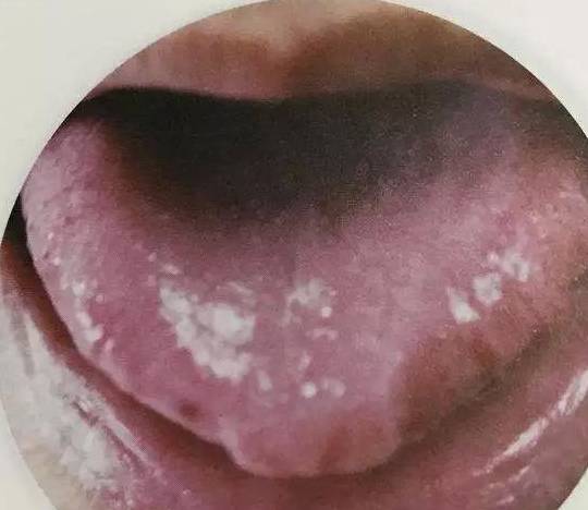 中药怎么洗掉颜色 53049cdf411841e1a7f7c338f2ea70f3.jpeg