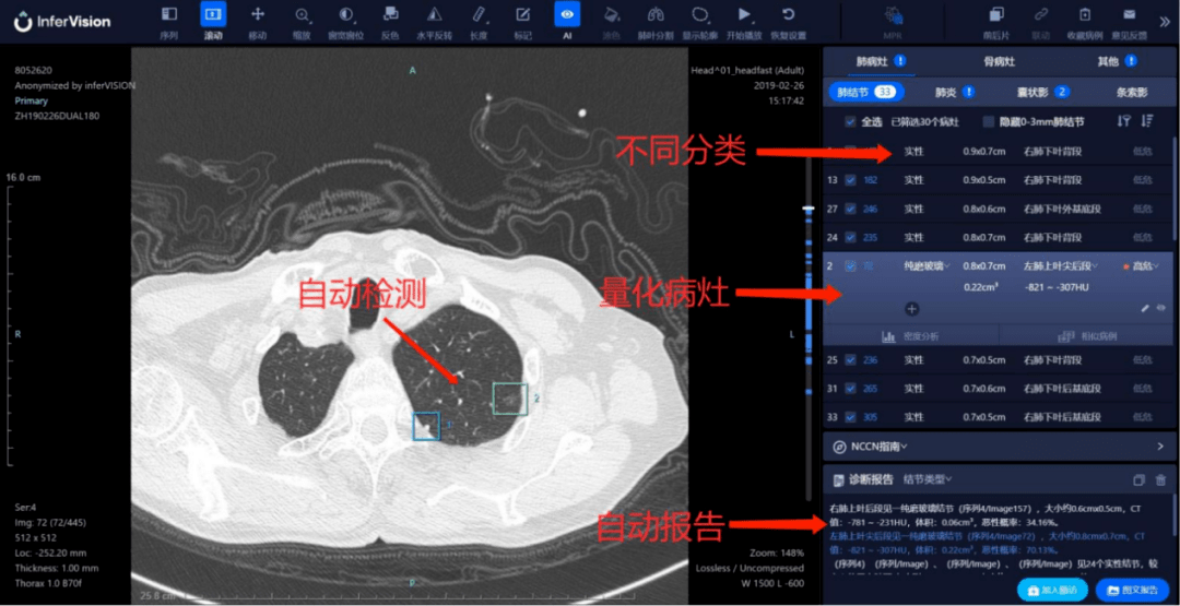 Tanker|影像分析、视网膜筛查、AI语音助手…谁能成为医疗AI落地的法宝？