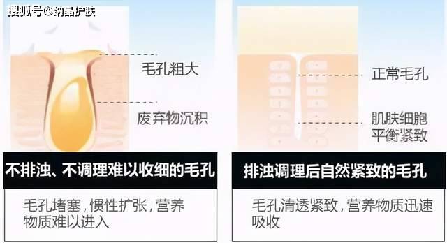 方法|夏天到了，我的毛孔粗大还有救吗？