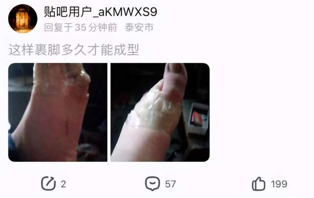 三寸金莲死灰复燃 这些大秀缠足的年轻人 是中了什么邪 眼界 多维客