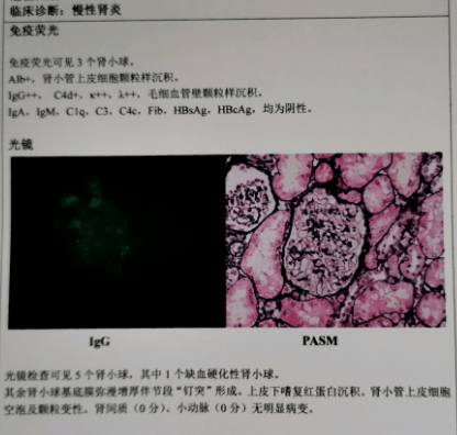 生活|前半生拿命换钱，后半生拿钱换命：二胎刚出生，我却患上了肾病！