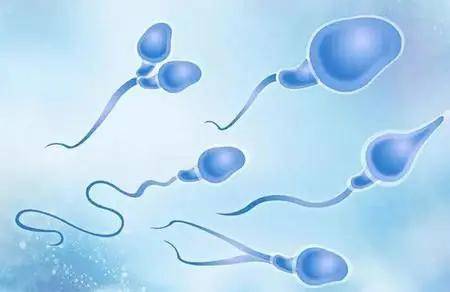 每10个男性当中,就会有2个精索静脉曲张,每10个不育症男性当中,就会有