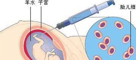 头胎|高龄产妇怀二胎要做的4项产检，别心大，怀孕风险比头胎大很多