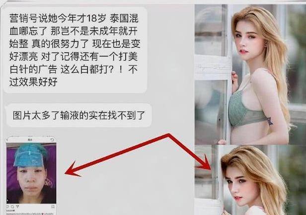 成功|19岁混血网红走红，全身上下多处整容，网友：整得太美了