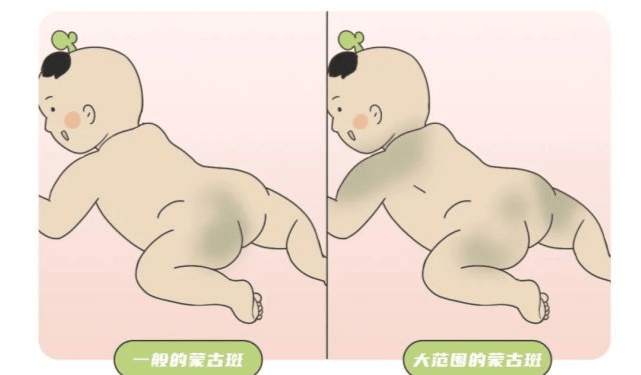 104b44a82c9a43408d24d14e9e657a8c.png