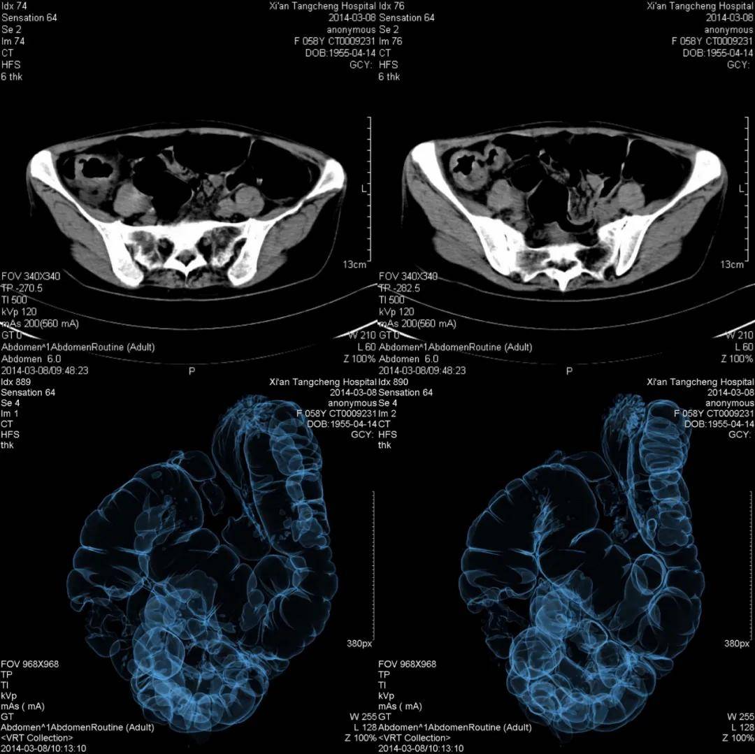 成像|【科室推荐】西安工会医院影像科