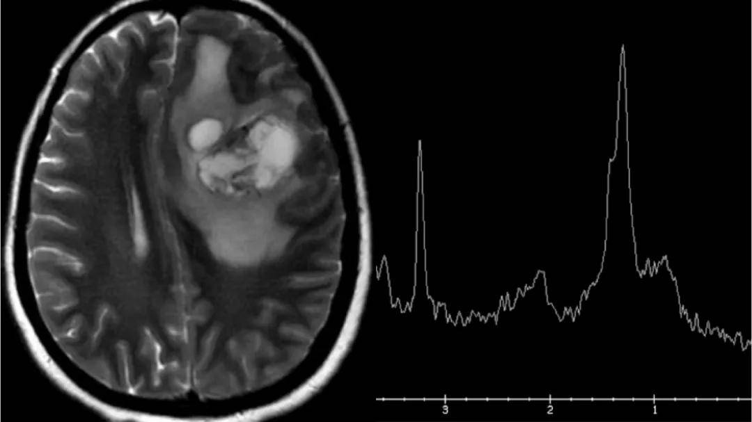 成像|【科室推荐】西安工会医院影像科