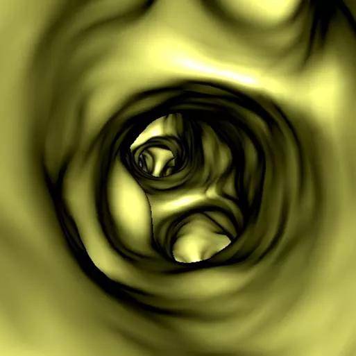 成像|【科室推荐】西安工会医院影像科