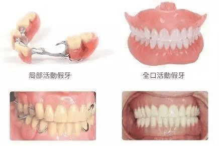 梦回现实，门牙前四颗牙的奇妙变身——解密假牙之梦的深层含义