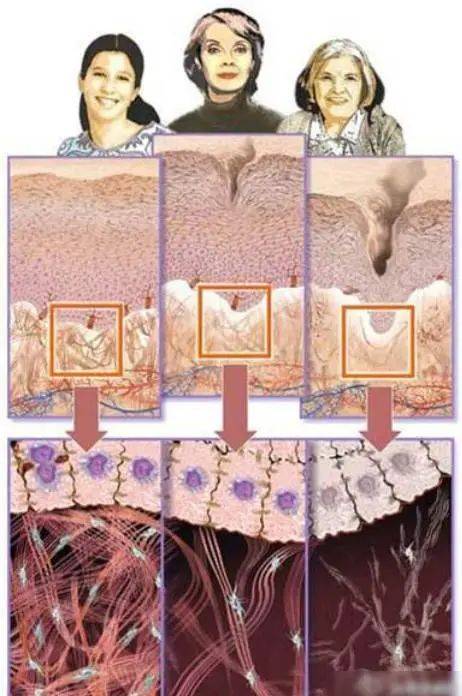 补充|华熙生物润致熨纹玻尿酸：快和静态额纹说拜拜~