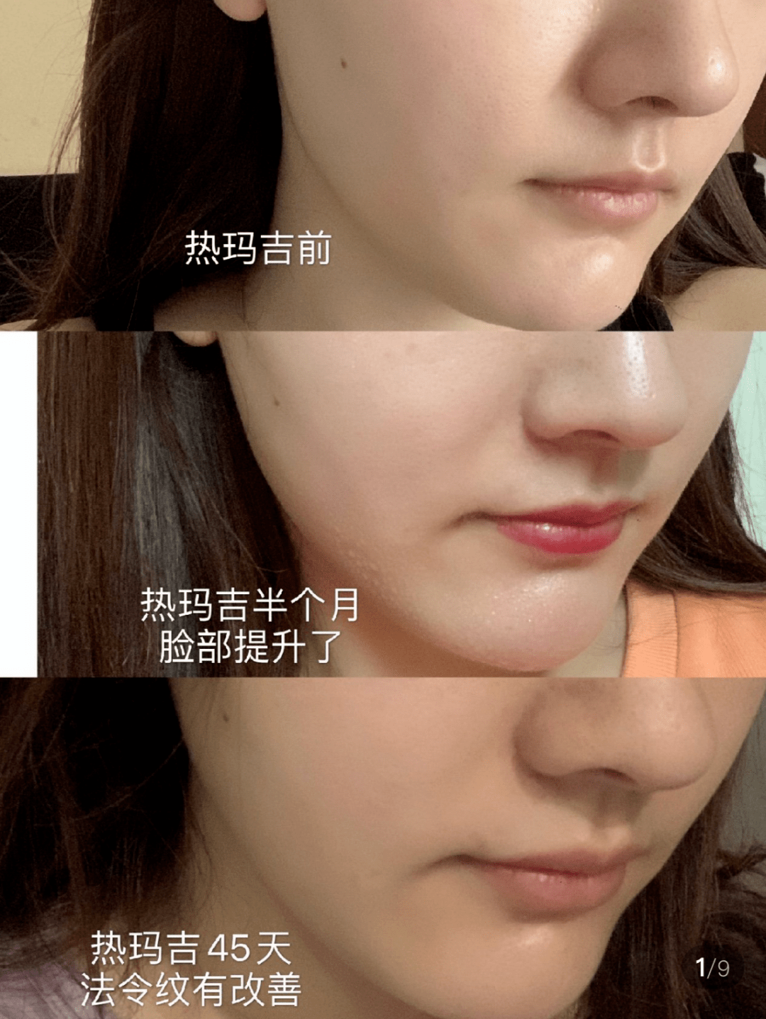 dd103312dcde43deb4e1140689de324f.png