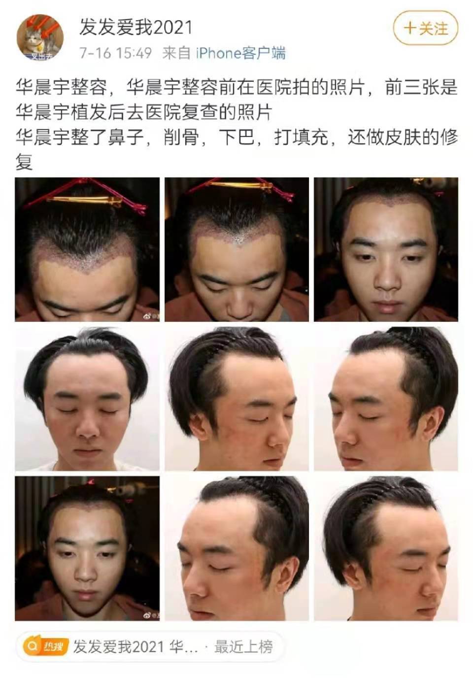 发声|疑似华晨宇前女友发声！曝其整容未公开照片，透露曾遭张碧晨施压