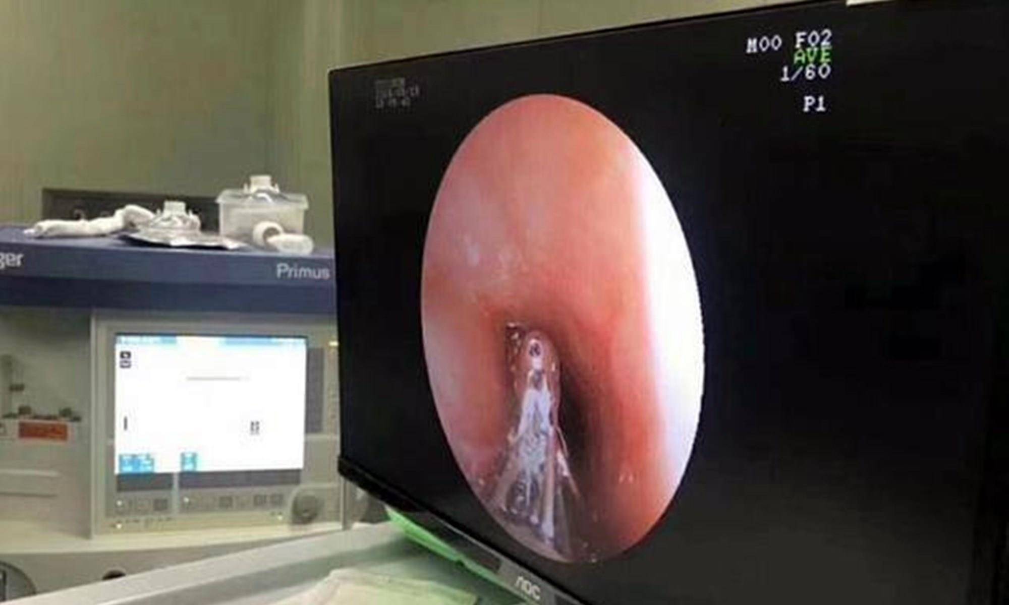 菲菲|父母眼中的“健康零食”，制作环境堪比垃圾场，父母至今蒙在鼓里