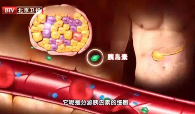 人体|早餐吃不对？健康早餐“5不吃”，这些东西尽量少碰……